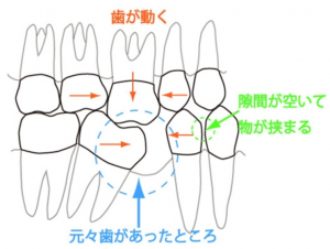 ほうち